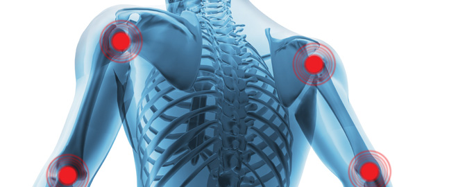 Platelet Rich Plasma for back pain