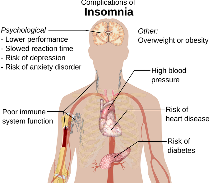 Complications_of_insomnia