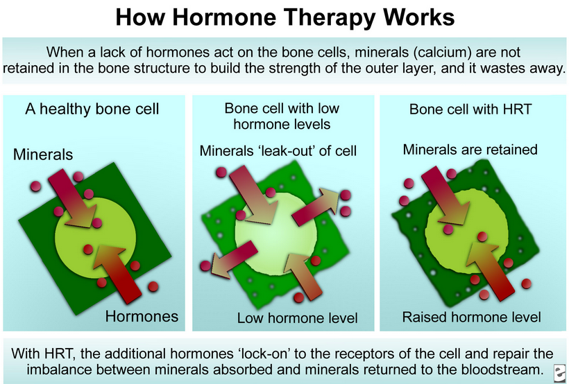 Estrogen replacement therapy (ERT)