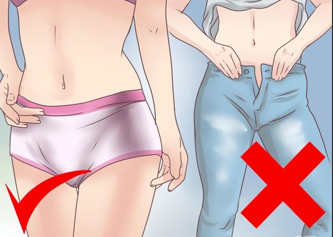 yeast-infection