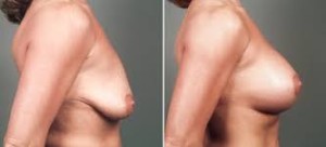The beauty of a woman is in her breast