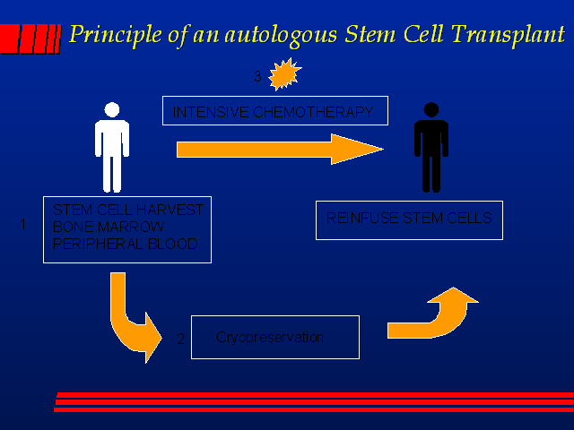 autologous stem cell transplant