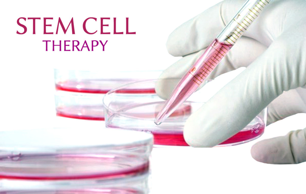 stem cell