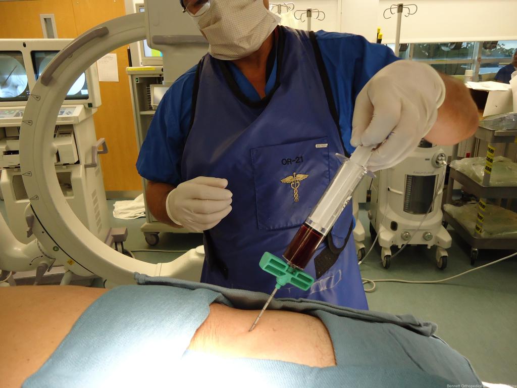 autologous stem cell