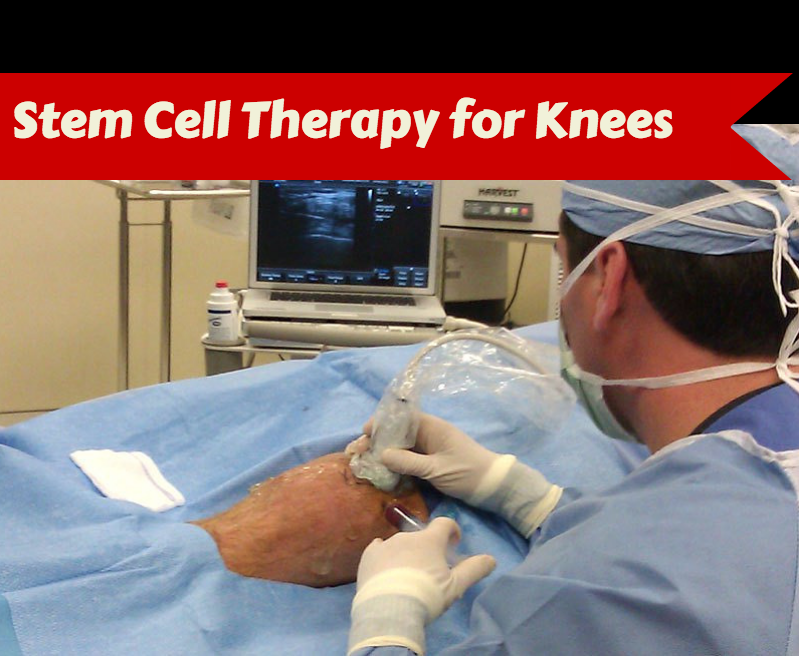 stem cell therapy 