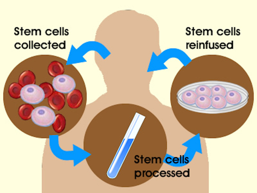 stem cells 