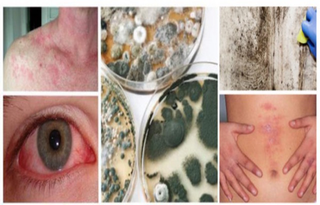 Toxic mold your silent killer
