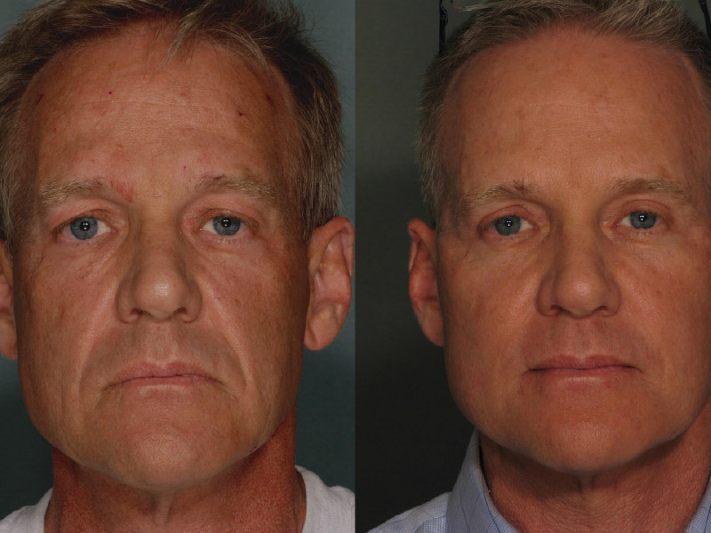 ageing skin naturally