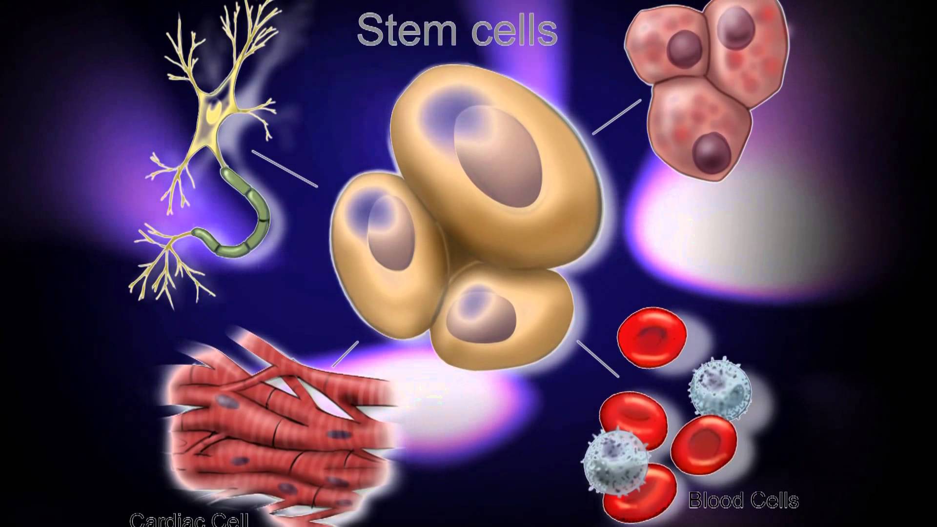 stem cell therapy