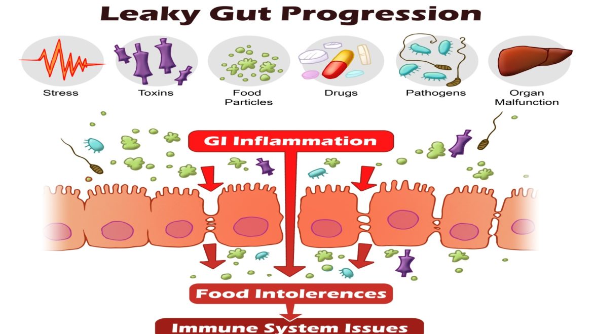 leaky gut and rheumatoid Autoimmune diseases