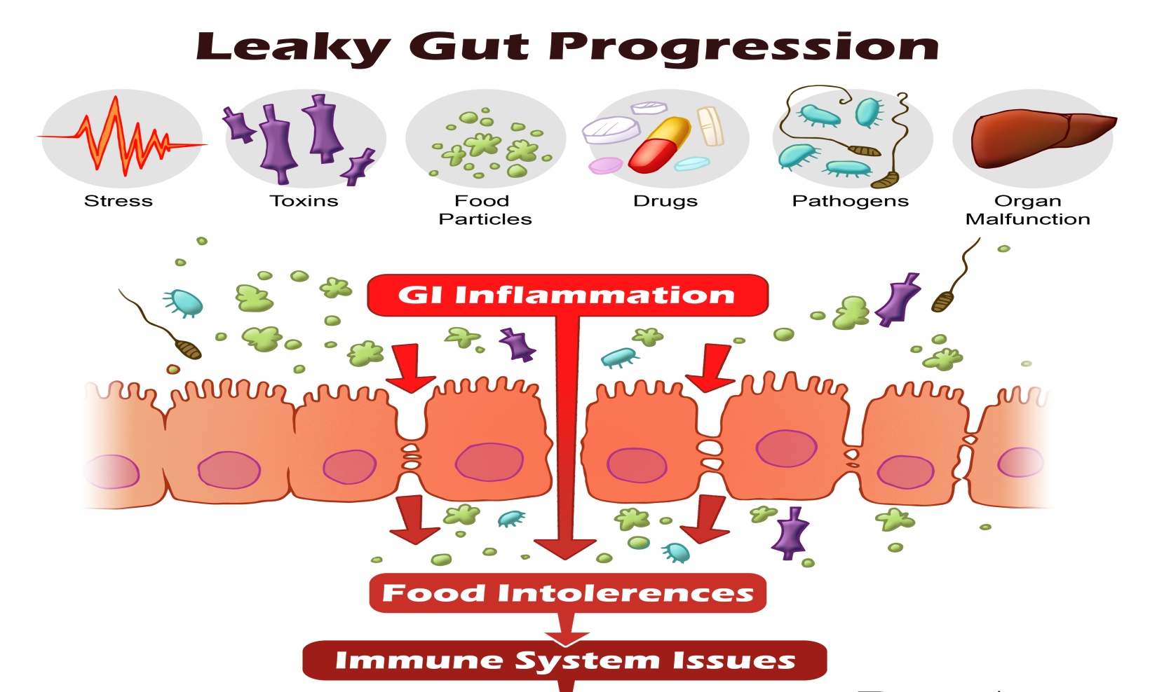 leaky gut and rheumatoid Autoimmune diseases